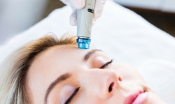 One or Three Hydrofacials and Custom Masks at Skin Envy Beauty and Spa (Up to 36% Off)