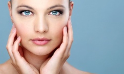One, Three, or Five Microdermabrasion Treatments at ChicMed Laser and Esthetic Center (Up to 76% Off)