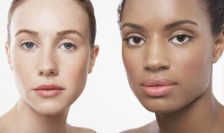 One, Two, or Three Laser Photo-Rejuvenation Treatments/IPL at Spade Skin Care & More (Up to 84% Off) 