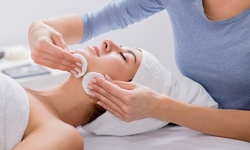 One Microneedling Sessions with Hyaluronic Acid Serum at Terra Spa (Up to 65% Off)