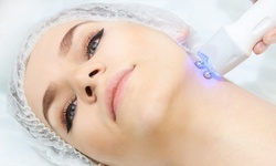 Up to 54% Off on Facial - Chemical Peel at Mythology Aesthetics