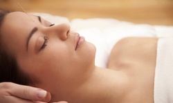 Up to 63% Off on Acupuncture Services at Texas Acupuncture Center