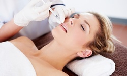 Injectables and Fillers at VE Medspa and Salon (Up to 54% Off). Five Options Available.