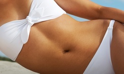 One or Two Cryo-Sculpting Sessions at CHC Weight Loss Center (Up to 72% Off)