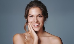 One or Two Teeth Whitening Sessions at Esthetic Style (Up to 58% Off)
