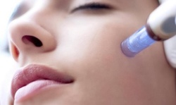 Up to 47% Off on Micro-Needling at Face2Face 3D/4D Studio & Spa