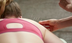 One or Three Acupuncture Treatments with Consultation from Kimberly Griffin at D'Arcy Naturals (Up to 80% Off)