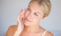 60 Units of Dysport at Aesthetica Skin Health and Wellness (Up to 47% Off)