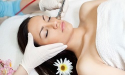 One or Three Microdermabrasion Treatments or Deep-Cleansing Facials at Hair Concepts (Up to 66% Off)