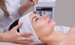 Microdermabrasion with LED Therapy or Erbium MicroLaser Peel at Golden Glow Medical Spa (Up to 73% Off)