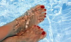 Laser Toenail-Fungus Removal Treatments for Up to Five or Ten Toes from Mitchell Wachtel, DPM (Up to 78% Off)