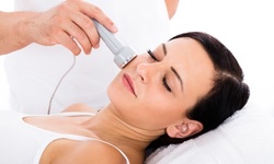 IPL Photofacial for Neck, Face or Decollete, or Face and Neck at Advanced Medical Weight Loss (Up to 73% Off)