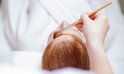 One or Two Hydrapeels at En Vogue Medi Spa & Plastic Surgery (Up to 74% Off)