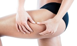 One or Three Wood Therapy Sessions at Evolution Of Her Beauty (Up to 35% Off)