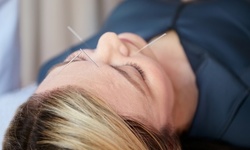 One or Three Acupuncture Sessions with Optional Motion Study X-ray at Pennridge Wellness Center (Up to 82% Off) 