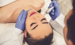 One Microdermabrasion Treatment with Optional Dermaplaning at Skin & Body Bar (Up to 51% Off)