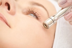 One or Two Microdermabrasion Treatments at Clayton Imaj (Up to 45% Off)