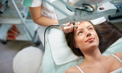 One or Two Diamond Microdermabrasion Treatments at BodyBrite (Up to 53% Off)