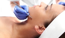 Up to 40% Off on Facial - Peeling at Vero Derm Aesthetic and Wellness Center