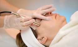 One, Two, or Three 20% Skin Ceuticals Peels w/ Diamond Microdermabrasion at New Dawn Medical Spa (Up to 54% Off)
