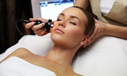 One, Two, or Three Ultra-Lift Skin-Tightening Sessions at Bel Air Cosmetic Services (Up to 84% Off)