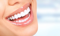 $47.20 for Oral Evaluation, Four Bite-Wing X-rays, and Cleaning at My Face My Smile ($280 Value)