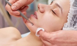 Up to 60% Off on Acne Treatment (Service) at Splendida Salon and Spa