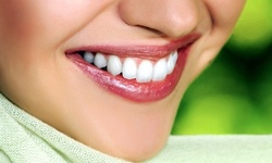 Up to 90% Off on Braces - Invisible - Branded (Invisalign) at Bliss Dental Lounge