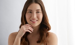 One or Two IPL Photofacials at Suite Six Medical Aesthetics (Up to 60% Off)