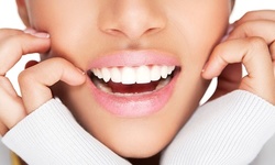 $79 for Dental Exam, X-Ray, and Basic Cleaning at MediDental Care ($540 Value)