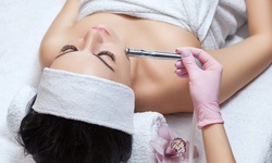 One or Two Microdermabrasion Treatments with Hydrofacial at Lux Beauty Studio (Up to 68% Off)