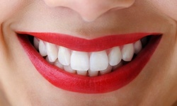 $139 for a Zoom! Teeth-Whitening Treatment from Dr. Pyle with Orlando Dental Group (a $500 Value)