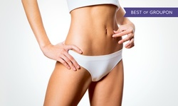 $119 for a Four-Week Weight-Loss Program at PREMIERE Center for Cosmetic Surgery ($325 Value)