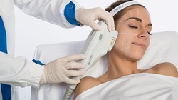 Ultherapy for Brow Lift, Jawline, or Face and Optional Neck at Dermix Medical Aesthetics Group (Up to 73% Off)