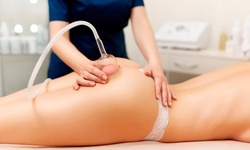 One or Two Cupping Sessions for Body Pain or Cellulite Treatment at EarthBound Skin Spa (Up to 75% Off)