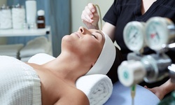 One, Two, or Three Microdermabrasion Facial Treatments at Skin Studio Laser Boutique (Up to 72%)
