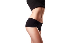 Liposuction on One Small or Large Area with Local Anesthesia at Noble Cosmetic Surgery (Up to 63% Off)