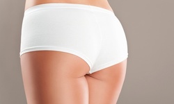 Two, Four, or Six Noninvasive Brazilian Butt Lifts and 3D Lipo at Natural Beauty Clinique (Up to 87% Off) 