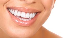 $49 for Braces Package with Consultation and X-rays at Navarro Orthodontix ($1,800 Value)