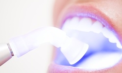 Up to 50% Off on Dental Checkup (Cleaning, X-Ray, Exam) at Serenity Addiction Day Spa