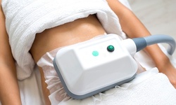 One or Three 60-Minute Ultrasonic Body Contouring Sessions at Right By U with A Twist (Up to 44% Off)