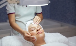 $149 for One CO2 Skin Resurfacing for Face (Lightest Depth, Surface Peel) ($299 Value)