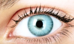 $100 for $1,500 Toward LASIK Vision-Correction Surgery at Mattioli Vision Professionals
