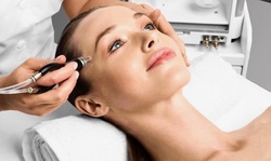 One or Three 50-Minute Silk Peel Dermal Infusions at Mirabella Skin Care (Up to 29% Off)