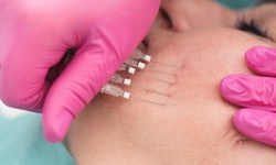 One or Three PDO Thread Lifts at Skin Play (Up to 66% Off). Three Options Available