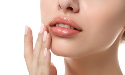 Up to 52% Off on Lip Enhancement at Luxe Lab Injections