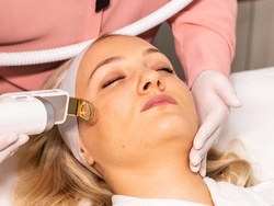 Pigmentation Reduction, Tightening and Rejuvenation, or Acne Treatment at Antea Spa (Up to 50% Off)