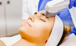 Skin Rejuvenation or Brown Spot Removal at NY Laser and Skin Clinic (Up to 50% Off). Two Options Available.