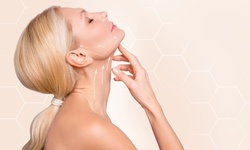 One or Two 60-minute Buccal Sculptural FaceLift Massage at Laser Skin Esthetics (Up to 60% Off)
