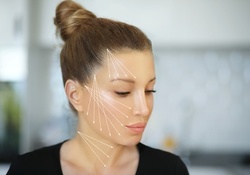 $975 for Four PDO Threads Including Two Threads per Side at True Bliss Medical ($1,500 Value)